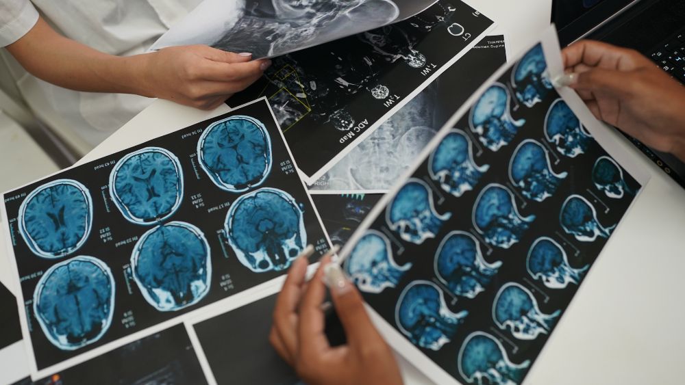 Brain Imaging - DR. ARUNAVA DATTA Blog